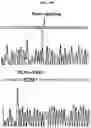 Fig. 10 - Trans-splicing ribozyme targeting rhodopsin transcript and uses thereof