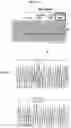 Fig. 11 - Trans-splicing ribozyme targeting rhodopsin transcript and uses thereof