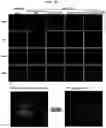 Fig. 12 - Trans-splicing ribozyme targeting rhodopsin transcript and uses thereof