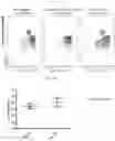 Fig. 33 - BETA-GLUCAN IMMUNOTHERAPIES AFFECTING THE IMMUNE MICROENVIRONMENT