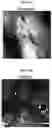 Fig. 05 - COMPOSITIONS OF MATTER WITH ACTIVITY TO REMOVE LIPOFUSCIN FROM RETINAL CELLS