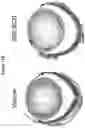 Fig. 16 - COMPOSITIONS OF MATTER WITH ACTIVITY TO REMOVE LIPOFUSCIN FROM RETINAL CELLS