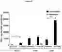 Fig. 75 - PROCESSES FOR PRODUCTION OF TUMOR INFILTRATING LYMPHOCYTES AND USES OF SAME IN IMMUNOTHERAPY