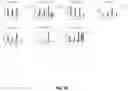 Fig. 19 - PLACENTA-DERIVED ALLOGENEIC CAR-T CELLS AND USES THEREOF