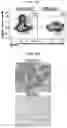 Fig. 25 - CONDITIONING AGENTS FOR USE IN ALLOGENEIC HEMATOPOETIC STEM CELL TRANSPLANTATION