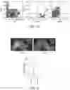 Fig. 08 - ABCB5(+) STEM CELLS FOR TREATING OCULAR DISEASE