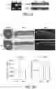 Fig. 11 - ABCB5(+) STEM CELLS FOR TREATING OCULAR DISEASE