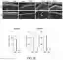 Fig. 12 - ABCB5(+) STEM CELLS FOR TREATING OCULAR DISEASE