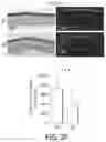 Fig. 13 - ABCB5(+) STEM CELLS FOR TREATING OCULAR DISEASE