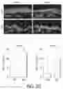 Fig. 14 - ABCB5(+) STEM CELLS FOR TREATING OCULAR DISEASE