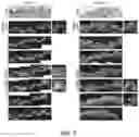 Fig. 24 - ABCB5(+) STEM CELLS FOR TREATING OCULAR DISEASE