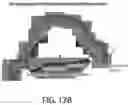 Fig. 40 - ABCB5(+) STEM CELLS FOR TREATING OCULAR DISEASE