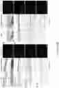 Fig. 05 - NANOFIBROUS ENCAPSULATION DEVICE FOR SAFE DELIVERY OF THERAPEUTIC AGENTS
