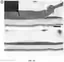 Fig. 10 - NANOFIBROUS ENCAPSULATION DEVICE FOR SAFE DELIVERY OF THERAPEUTIC AGENTS