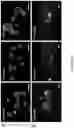 Fig. 20 - NANOFIBROUS ENCAPSULATION DEVICE FOR SAFE DELIVERY OF THERAPEUTIC AGENTS
