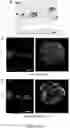 Fig. 30 - NANOFIBROUS ENCAPSULATION DEVICE FOR SAFE DELIVERY OF THERAPEUTIC AGENTS