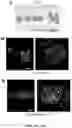 Fig. 36 - NANOFIBROUS ENCAPSULATION DEVICE FOR SAFE DELIVERY OF THERAPEUTIC AGENTS