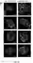 Fig. 42 - NANOFIBROUS ENCAPSULATION DEVICE FOR SAFE DELIVERY OF THERAPEUTIC AGENTS