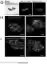 Fig. 43 - NANOFIBROUS ENCAPSULATION DEVICE FOR SAFE DELIVERY OF THERAPEUTIC AGENTS