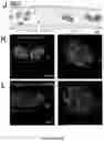 Fig. 44 - NANOFIBROUS ENCAPSULATION DEVICE FOR SAFE DELIVERY OF THERAPEUTIC AGENTS