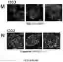 Fig. 45 - NANOFIBROUS ENCAPSULATION DEVICE FOR SAFE DELIVERY OF THERAPEUTIC AGENTS