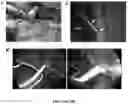 Fig. 49 - NANOFIBROUS ENCAPSULATION DEVICE FOR SAFE DELIVERY OF THERAPEUTIC AGENTS