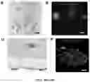 Fig. 51 - NANOFIBROUS ENCAPSULATION DEVICE FOR SAFE DELIVERY OF THERAPEUTIC AGENTS