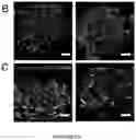 Fig. 55 - NANOFIBROUS ENCAPSULATION DEVICE FOR SAFE DELIVERY OF THERAPEUTIC AGENTS