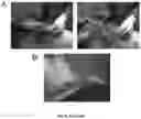Fig. 60 - NANOFIBROUS ENCAPSULATION DEVICE FOR SAFE DELIVERY OF THERAPEUTIC AGENTS
