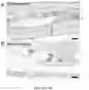Fig. 62 - NANOFIBROUS ENCAPSULATION DEVICE FOR SAFE DELIVERY OF THERAPEUTIC AGENTS