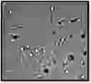 Fig. 01 - Fructophilic lactic acid producing bacteria