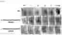 Fig. 02 - LACTOBACILLUS FERMENTUM WIKIM0102 HAVING ANTICANCER ACTIVITY AND COMPOSITION COMPRISING SAME AS ACTIVE INGREDIENT