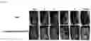 Fig. 04 - LACTOBACILLUS FERMENTUM WIKIM0102 HAVING ANTICANCER ACTIVITY AND COMPOSITION COMPRISING SAME AS ACTIVE INGREDIENT