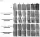 Fig. 07 - LACTOBACILLUS FERMENTUM WIKIM0102 HAVING ANTICANCER ACTIVITY AND COMPOSITION COMPRISING SAME AS ACTIVE INGREDIENT
