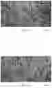 Fig. 03 - Method for improving sarcopenia by using 