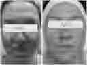Fig. 01 - SKIN CLARIFIER