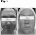 Fig. 02 - SKIN CLARIFIER