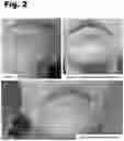 Fig. 03 - SKIN CLARIFIER