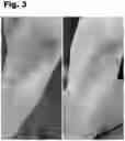 Fig. 04 - SKIN CLARIFIER