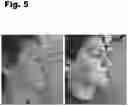 Fig. 06 - SKIN CLARIFIER