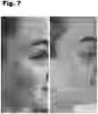Fig. 08 - SKIN CLARIFIER