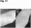 Fig. 12 - SKIN CLARIFIER