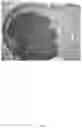 Fig. 02 - METHOD OF TREATING GLIOBLASTOMA