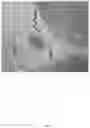 Fig. 03 - METHOD OF TREATING GLIOBLASTOMA