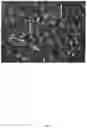 Fig. 04 - METHOD OF TREATING GLIOBLASTOMA