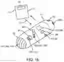 Fig. 03 - CLOTTING FACTOR PREPARATIONS FOR DELIVERY INTO TISSUE OF THE INTESTINAL TRACT USING A SWALLOWABLE DRUG DELIVERY DEVICE