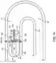 Fig. 15 - CLOTTING FACTOR PREPARATIONS FOR DELIVERY INTO TISSUE OF THE INTESTINAL TRACT USING A SWALLOWABLE DRUG DELIVERY DEVICE