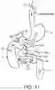 Fig. 18 - CLOTTING FACTOR PREPARATIONS FOR DELIVERY INTO TISSUE OF THE INTESTINAL TRACT USING A SWALLOWABLE DRUG DELIVERY DEVICE