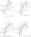 Fig. 19 - CLOTTING FACTOR PREPARATIONS FOR DELIVERY INTO TISSUE OF THE INTESTINAL TRACT USING A SWALLOWABLE DRUG DELIVERY DEVICE