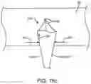 Fig. 37 - CLOTTING FACTOR PREPARATIONS FOR DELIVERY INTO TISSUE OF THE INTESTINAL TRACT USING A SWALLOWABLE DRUG DELIVERY DEVICE